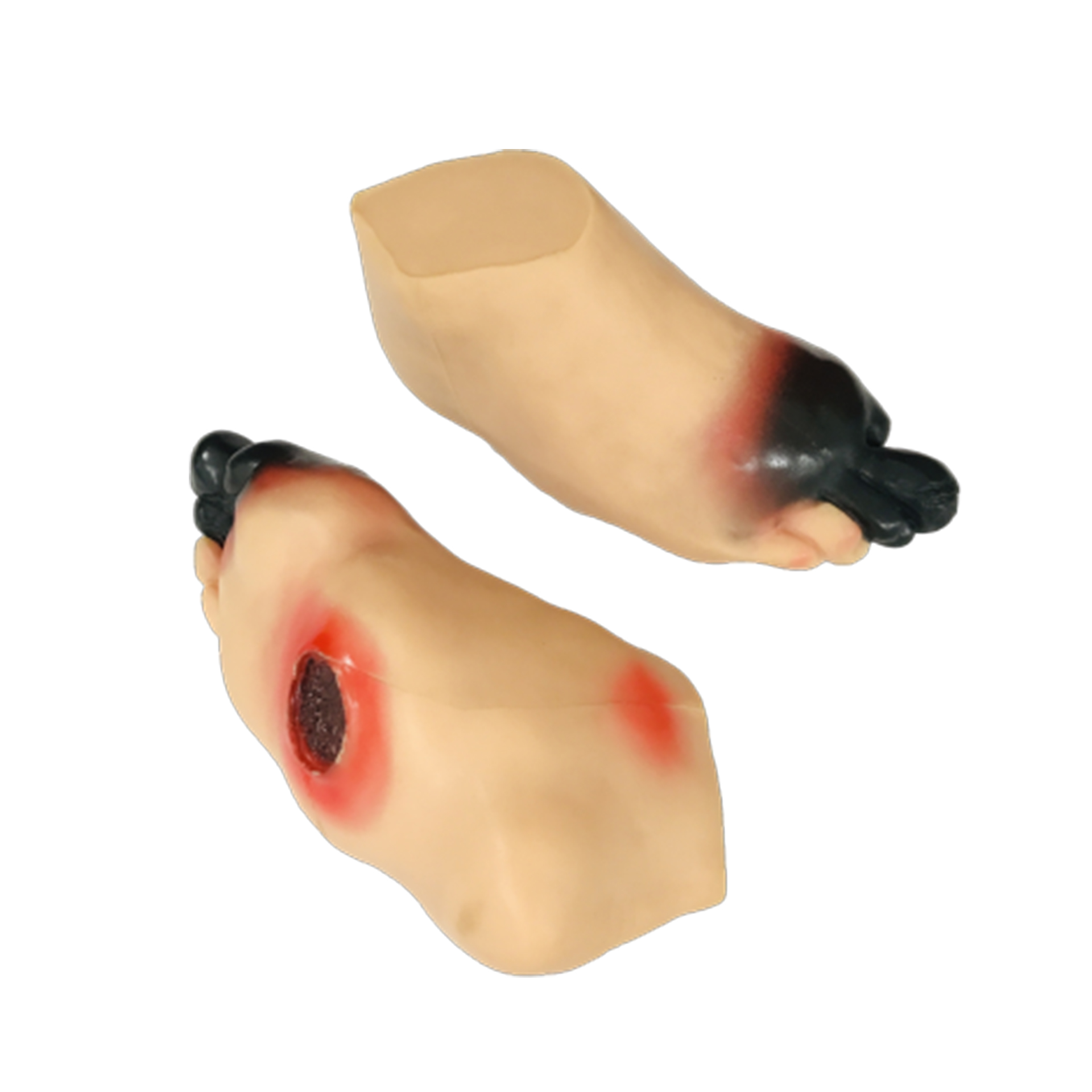 Model Kaki Diabetik Image